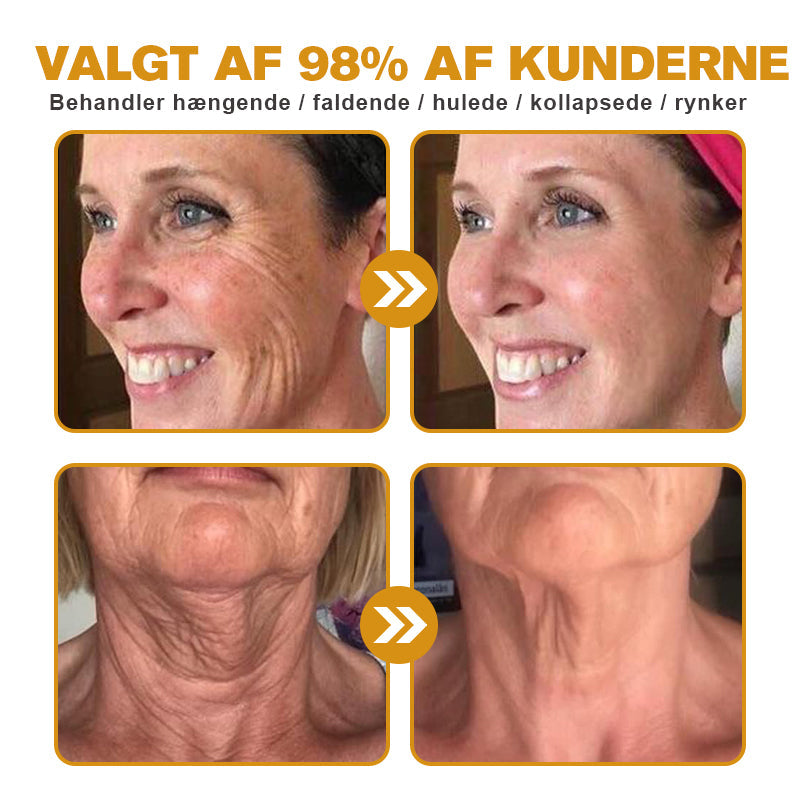 Nuvéra V2 Pro™ - Glat rynker, løft dit udseende – uden dyre behandlinger!