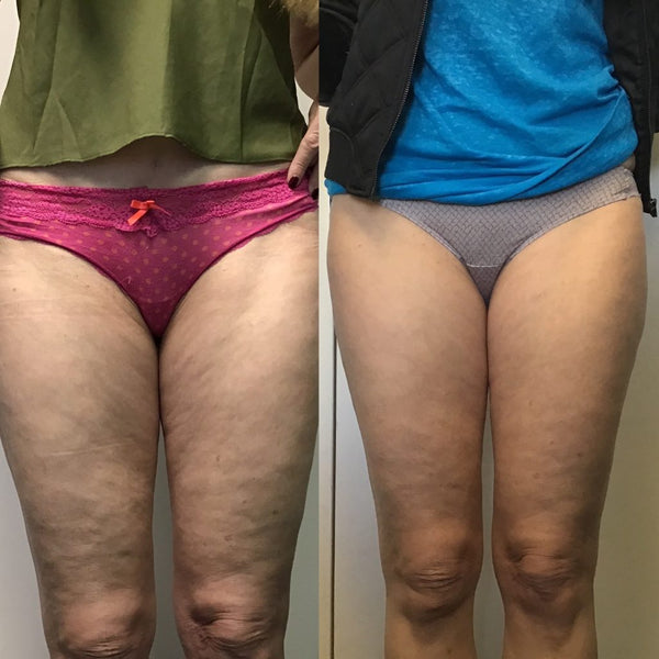 De nyeste resultater – direkte fra vores community