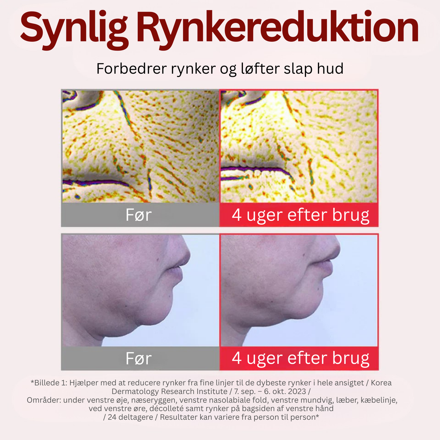 DermaTECA™ - Synligt færre rynker på bare 4 uger