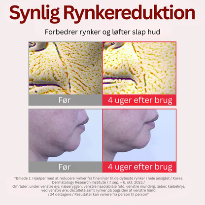 DermaTECA™ - Synligt færre rynker på bare 4 uger