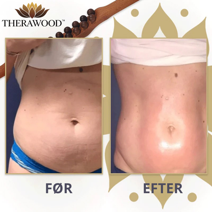 TheraWood™ - Naturlig lindring mod cellulite og hævelse!