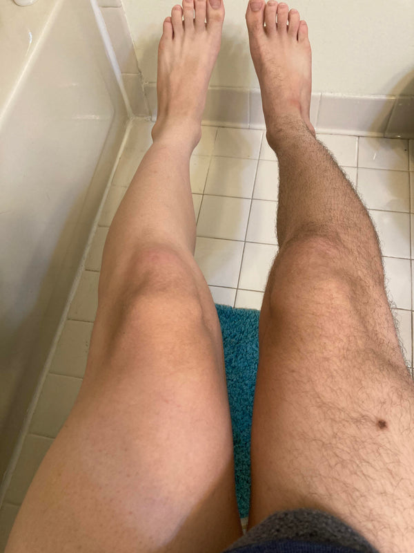 Tro ikke bare på os, se selv forskellen med BareEase™ Hårfjerningsskum hos vores kunder!