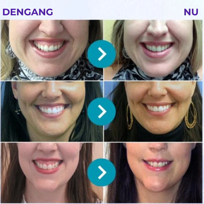 Parodentix™ - Fjerner plak og styrker tandkød naturligt