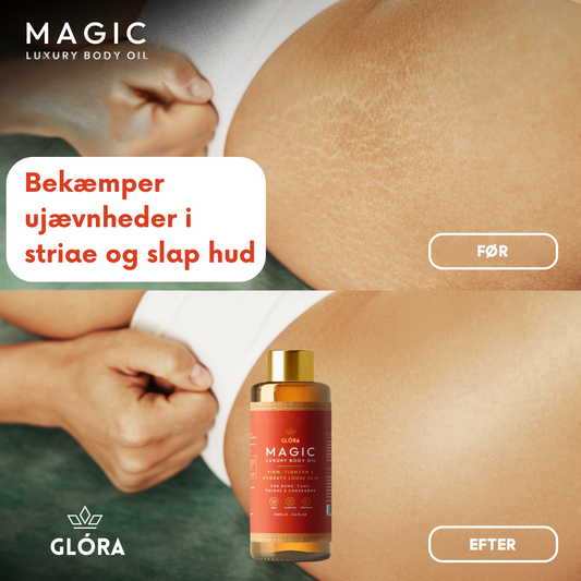 Glóra Magic Body Oil - Farvel til Tør, Slap Hud & Strækmærke