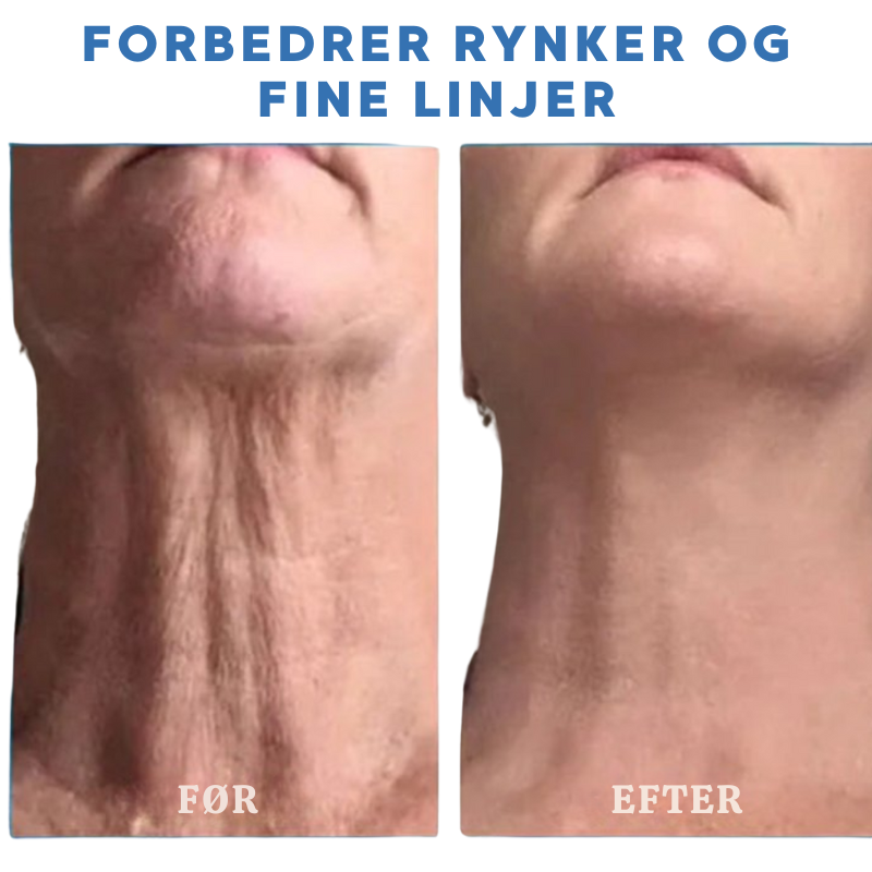 VitaPure V2 PRO | Sig farvel til crepet og slap hud - forvandl dit look!