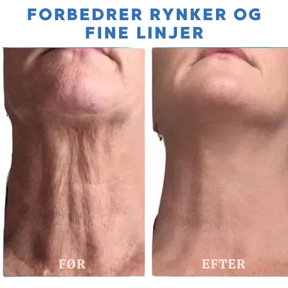 VitaPure V2 PRO | Sig farvel til crepet og slap hud - forvandl dit look!