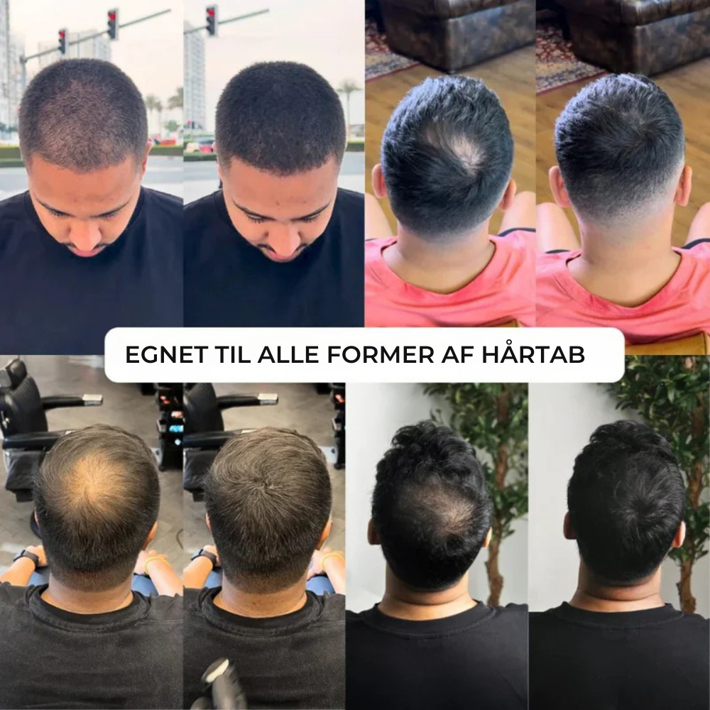 HairFill™ Hårlinje Pulver - Synligt fyldigere hår på få sekunder!