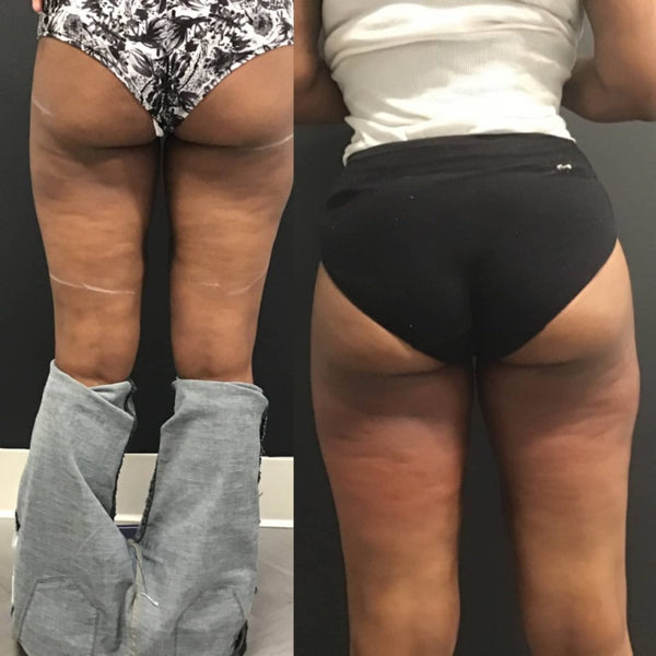 De nyeste resultater – direkte fra vores community