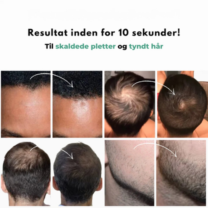 HairFill™ Hårlinje Pulver - Synligt fyldigere hår på få sekunder!