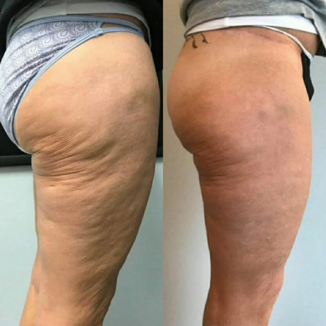 VitaGlow™ Oil - Strammer og løfter slap hud med 98 % inden for 24 timer