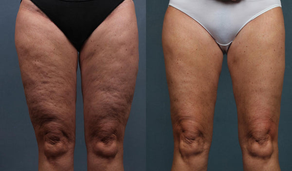 De nyeste resultater – direkte fra vores community