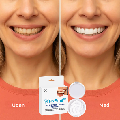 FixSmil™ Tandfacader | Smukke hvide tænder på kun 60 sekunder!